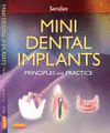 MINI DENTAL IMPLANTS