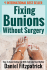 FIXING BUNIONS WITHOUT SURGERY