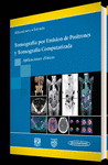 TOMOGRAFIA POR EMISION DE POSITRONES Y TOMOGRAFIA COMPUTARIZADA