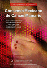 CONSENSO MEXICANO DE CANCER MAMARIO