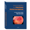 GUA ICONOGRFICA DE PATRONES HISTEROSCPICOS