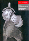 CHOQUE FEMOROACETABULAR