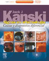 SIGNOS DE OFTALMOLOGIA. CAUSAS Y DIAGNOSTICO DIFERENCIAL + EXPERT CONSULT