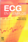 ECG EN EJEMPLOS