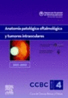 SECCI�N 4: ANATOM�A PATOL�GICA OFTALMOL�GICA Y TUMORES INTRAOCULARES. 2011-2012