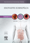 ESOFAGITIS EOSINOF�LICA