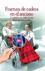 FRACTURA DE CADERA EN EL ANCIANO