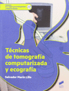 T�CNICAS DE TOMOGRAF�A COMPUTERIZADA Y ECOGRAFIA. CFGS.