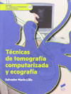 TCNICAS DE TOMOGRAFA COMPUTERIZADA Y ECOGRAFIA. CFGS.