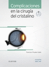 COMPLICACIONES EN LA CIRUGA DEL CRISTALINO + ACCESO WEB