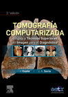 TOMOGRAF�A COMPUTARIZADA DIRIGIDA A T�CNICOS SUPERIORES EN IMAGEN PARA EL DIAGN�