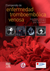 COMPENDIO DE ENFERMEDAD TROMBOEMBLICA VENOSA