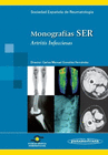 SER: ARTRITIS INFECCIOSAS