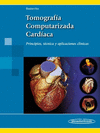 TOMOGRAFA COMPUTARIZADA CARDACA