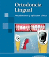 ORTODONCIA LINGUAL. PROCEDIMIENTOS Y APLICACION CLINICA